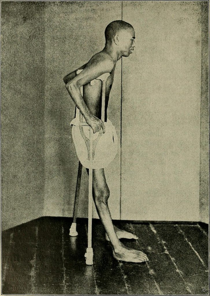 Micronutrients Matter: Thiamine (Vitamin&nbsp;B1)